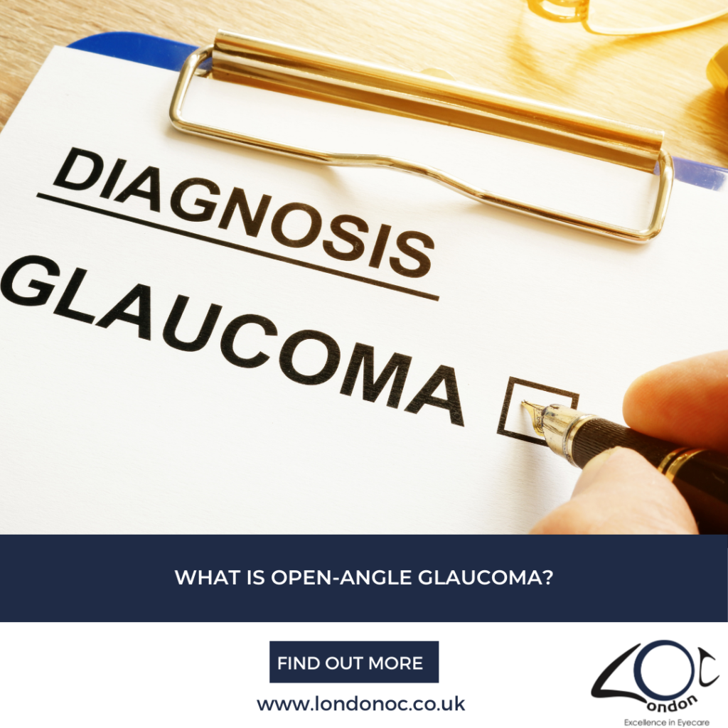 What is open-angle glaucoma? - LondonOC - Glaucoma