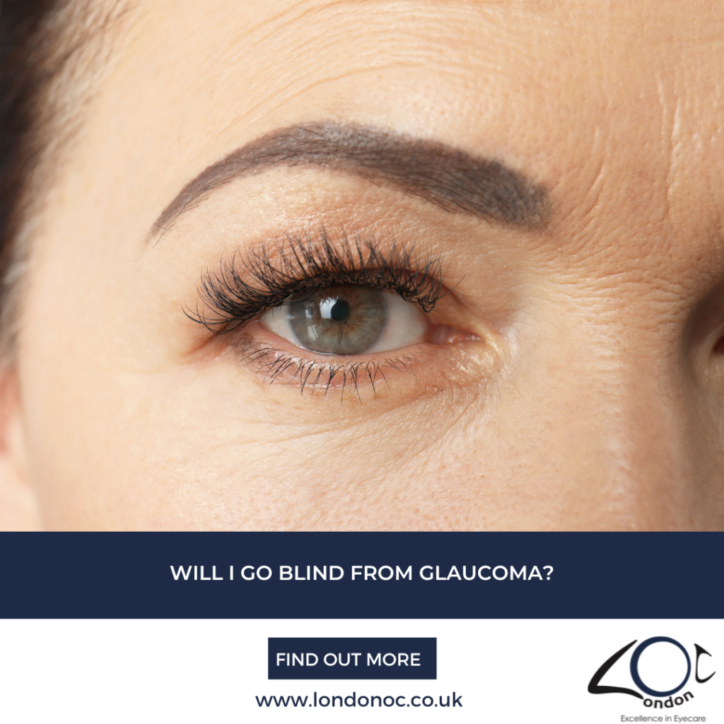Will I go blind from Glaucoma? - LondonOC - Glaucoma Specialist