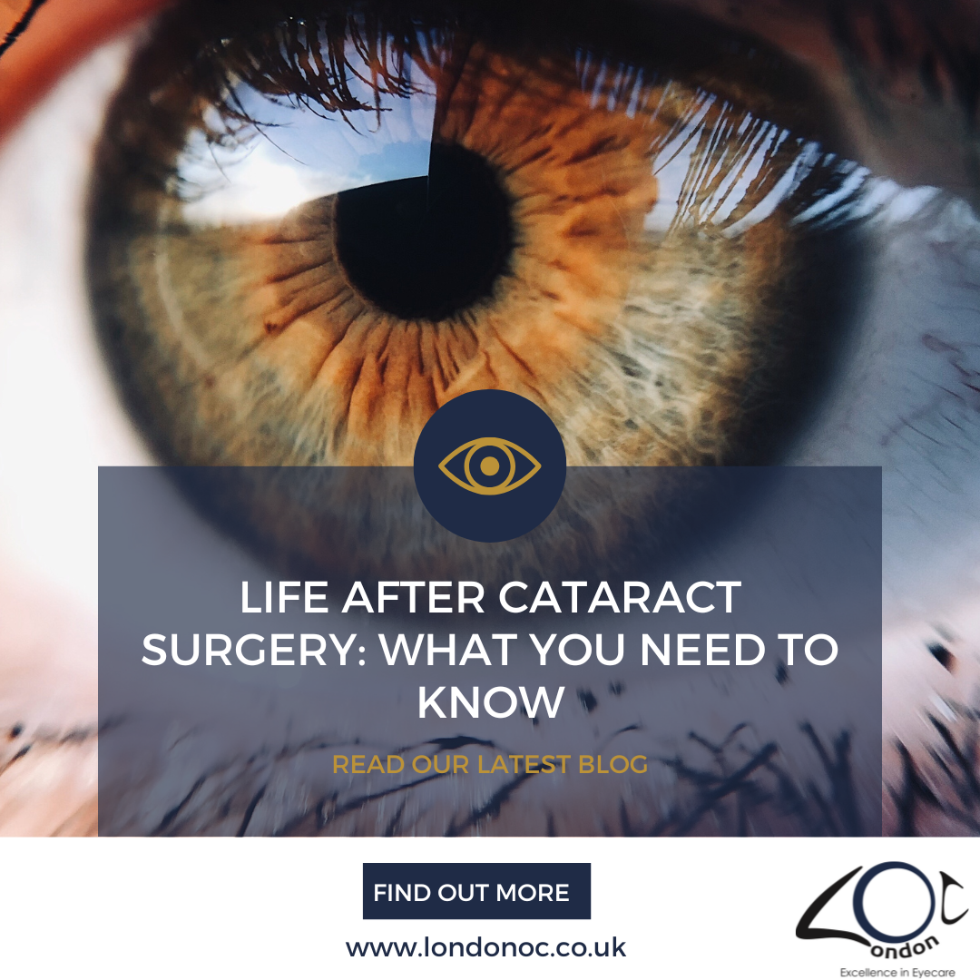 Life after cataract surgery: What you need to know - LondonOC