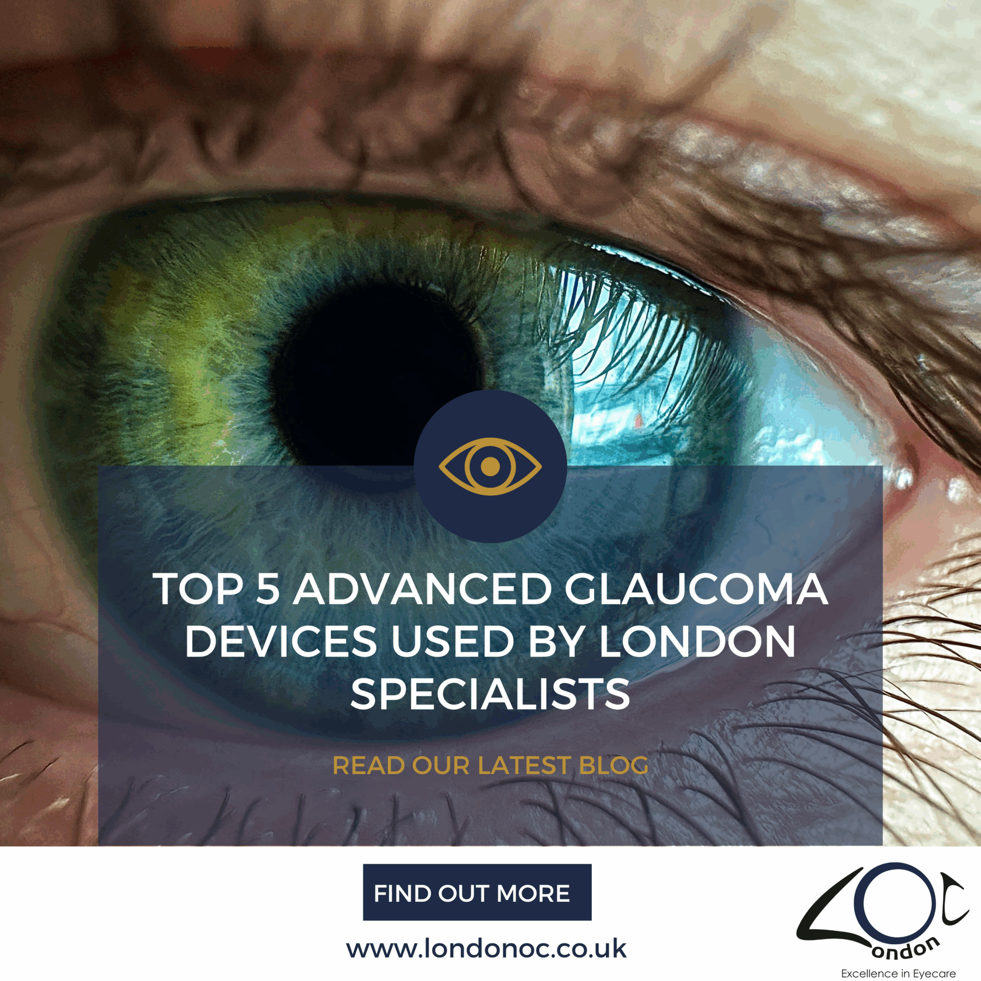 Top 5 advanced glaucoma devices used by specialists - LondonOC