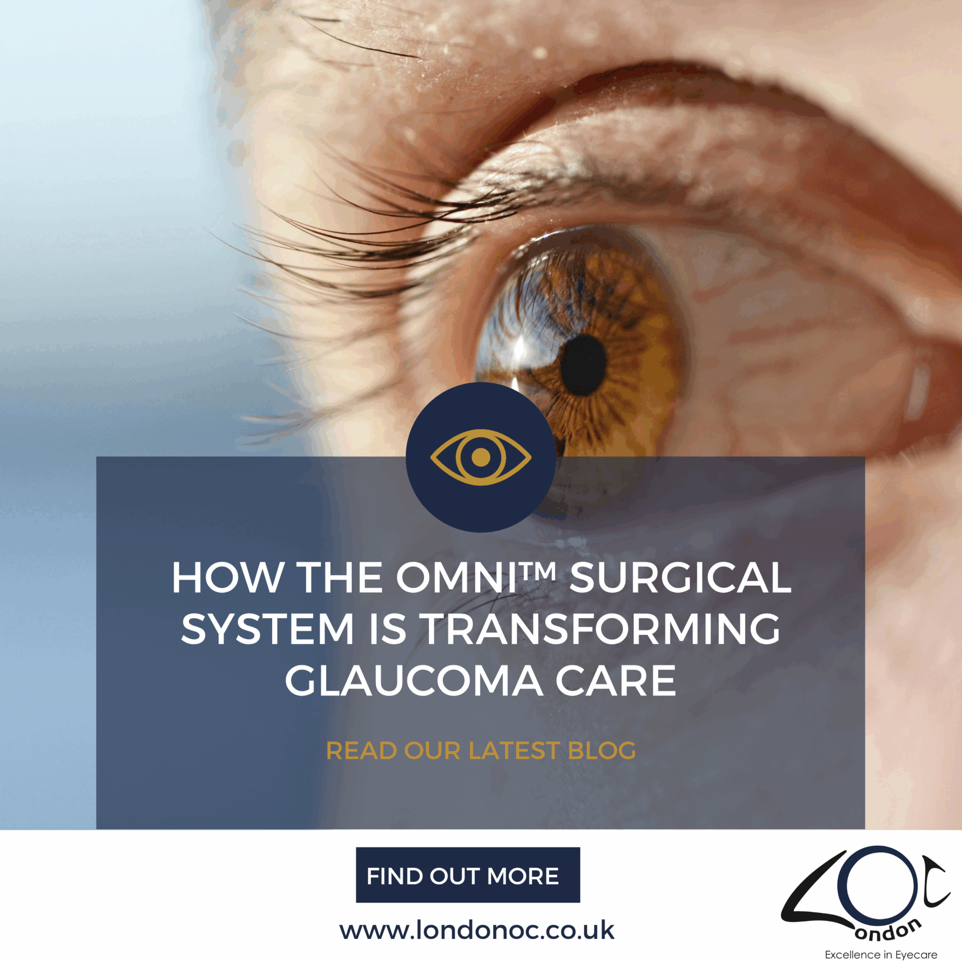 OMNI™ Surgical System is transforming glaucoma care LondonOC
