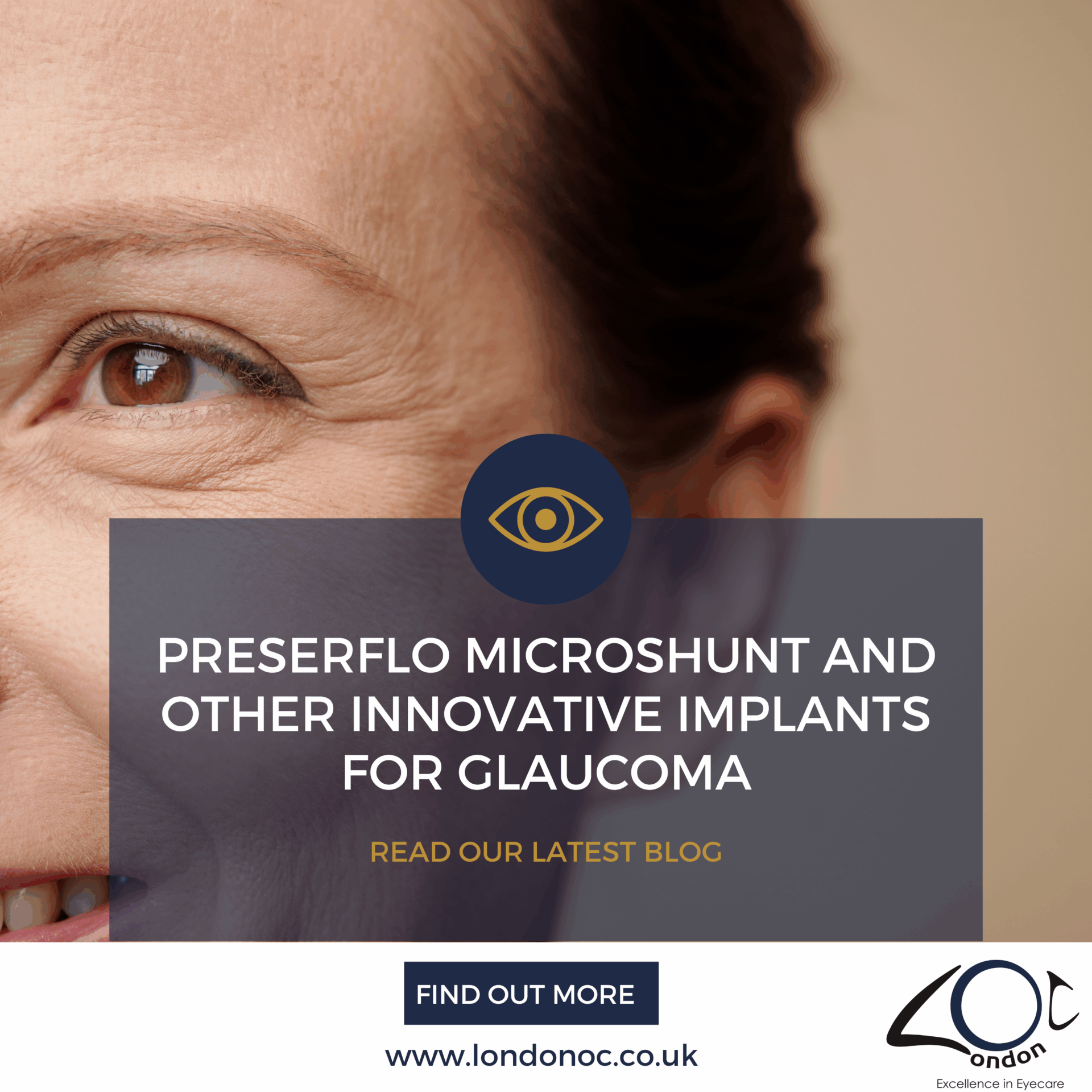 Preserflo Microshunt and other innovative implants for glaucoma