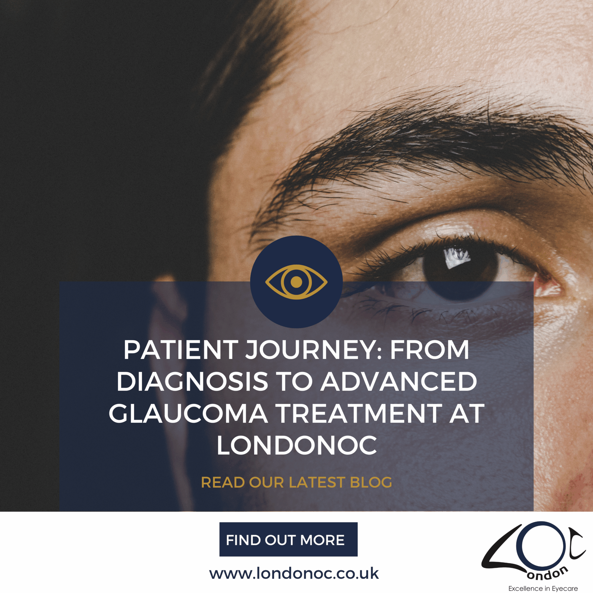 From diagnosis to advanced glaucoma treatment at LondonOCFrom diagnosis to advanced glaucoma treatment at LondonOC
