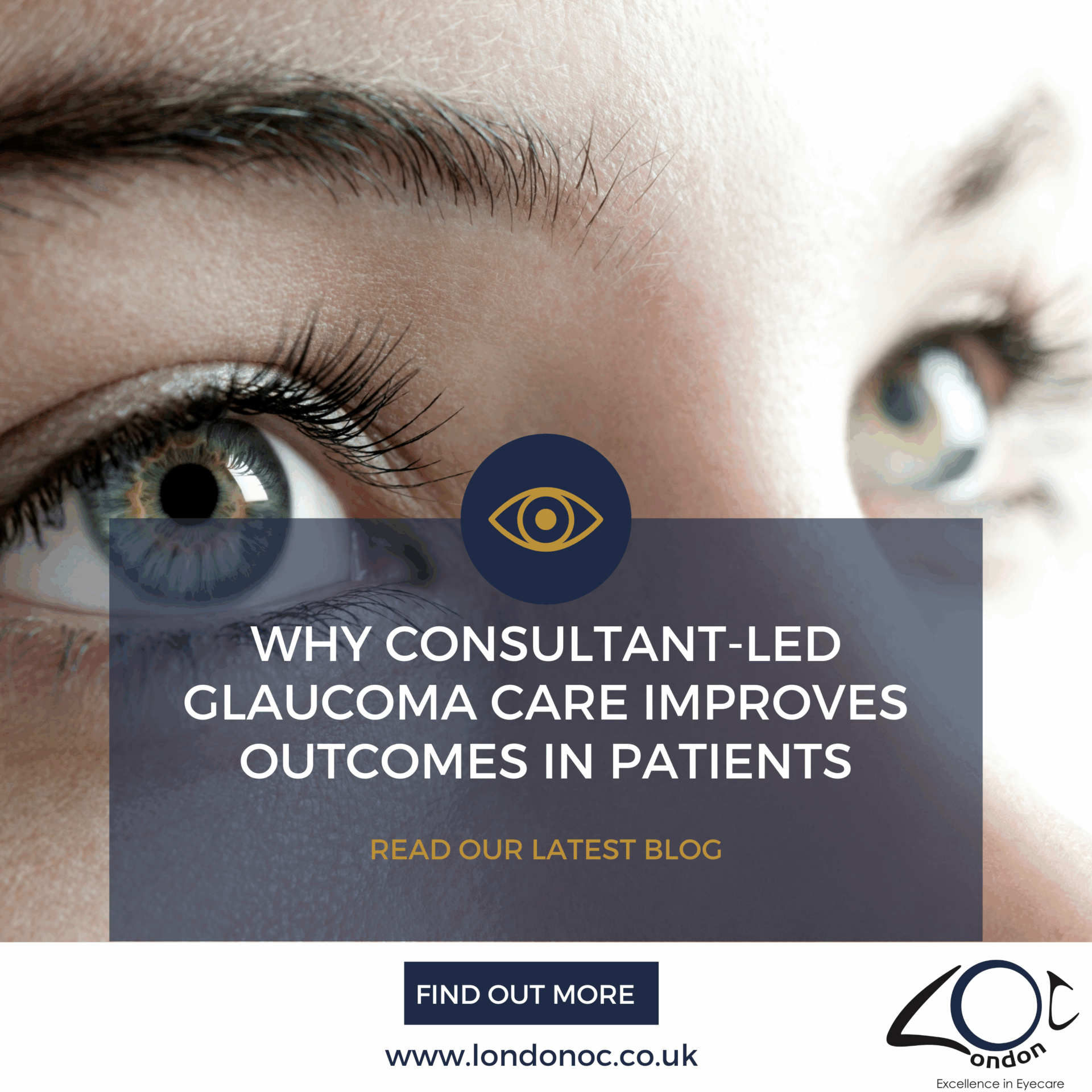 Why Consultant-led glaucoma care improves outcomes LondonOC