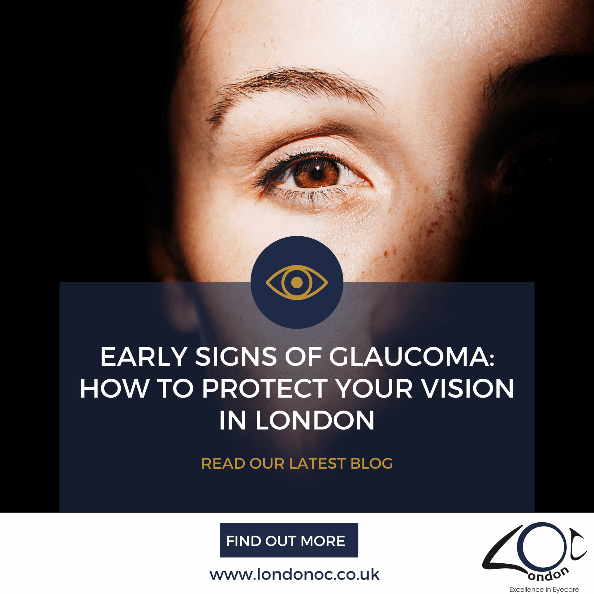 Early signs of Glaucoma: How to protect your vision in LondonOC