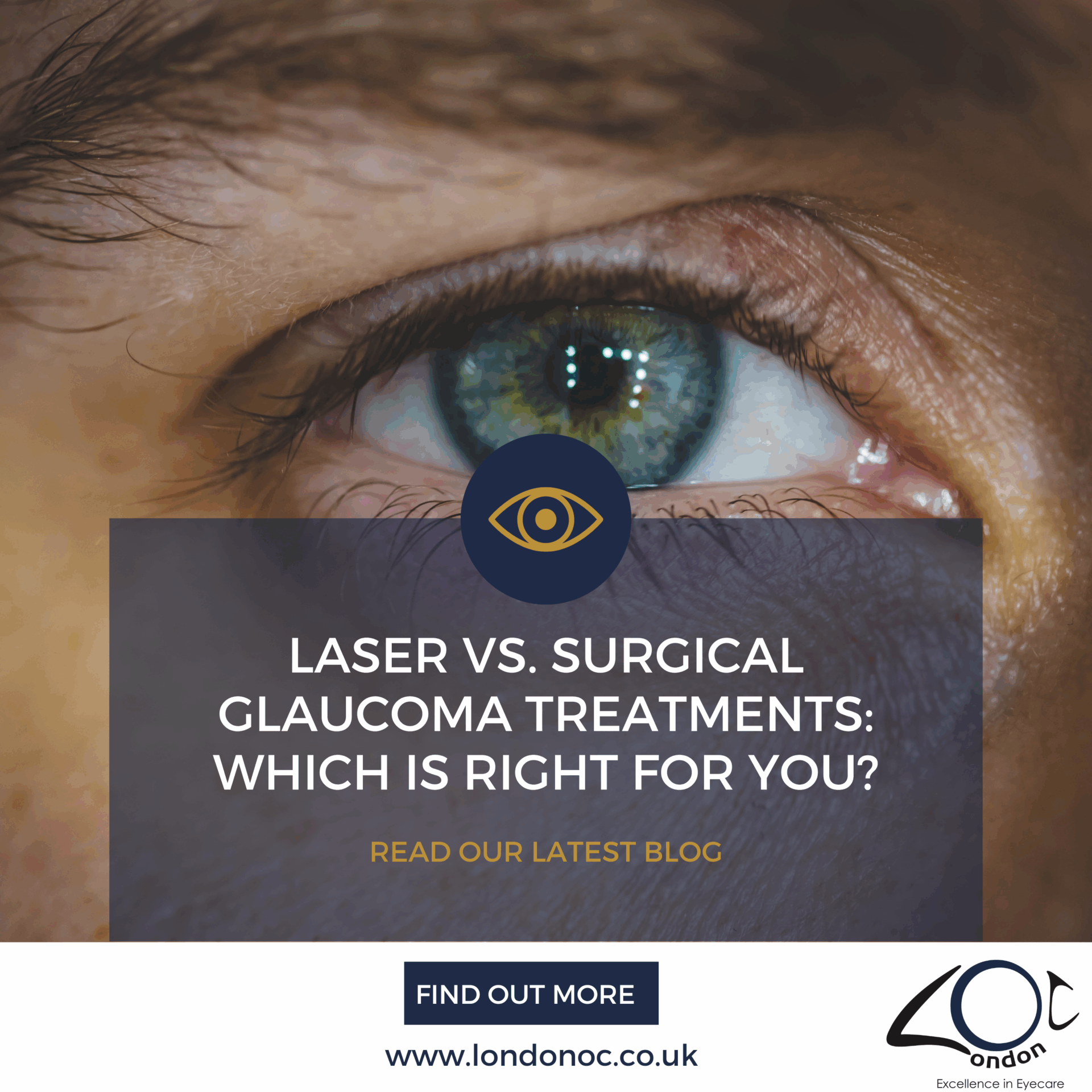 Laser vs. Surgical glaucoma treatments: Which is right for you?