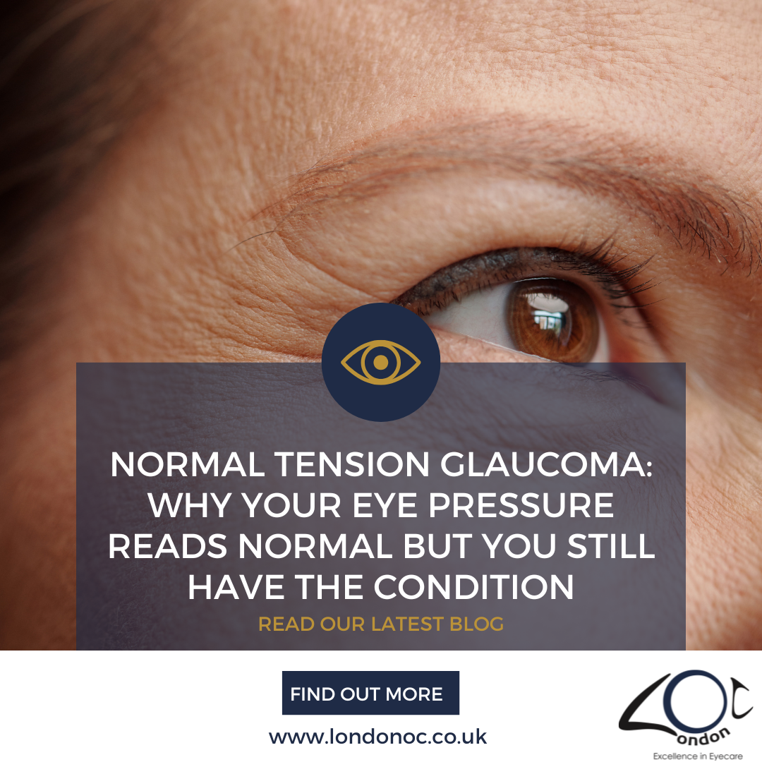 Normal Tension Glaucoma: Why Your Eye Pressure Reads Normal But You Still Have the Condition | London OC