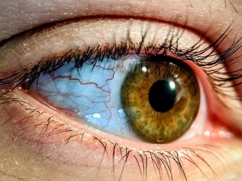 a close up of a person's brown eye