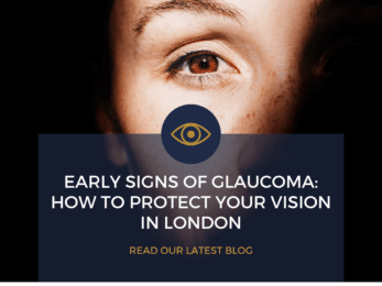 Early signs of Glaucoma: How to protect your vision in LondonOC
